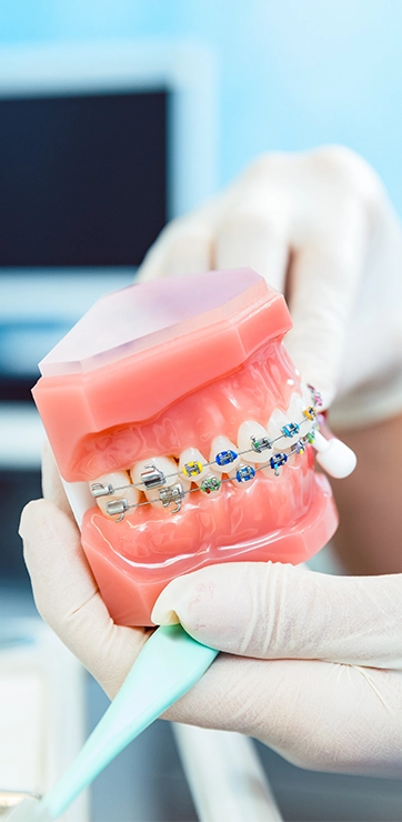 Plastic Mouth With Braces And Colorful Rubber Bands